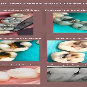 Bild von BG Dental Wellness and Cosmetic Center