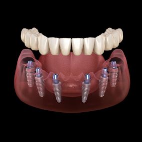 Bild von Smooth Dental and Orthodontics