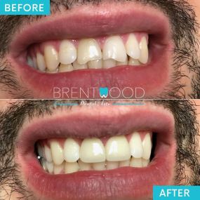 Bild von Brentwood Dental Arts