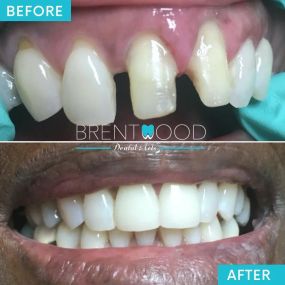 Bild von Brentwood Dental Arts