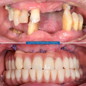 Bild von Clinica Dentaria Bellinzona Schulthess & Ottobrelli