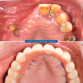 Bild von Clinica Dentaria Bellinzona Schulthess & Ottobrelli