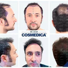 Bild von Cosmedica - Clinique de greffe de cheveux France