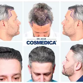 Bild von Cosmedica - Clinique de greffe de cheveux France