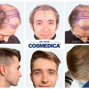 Bild von Cosmedica - Clinique de greffe de cheveux France