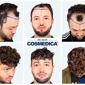 Bild von Cosmedica - Clinique de greffe de cheveux France