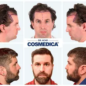 Bild von Cosmedica - Clinique de greffe de cheveux France