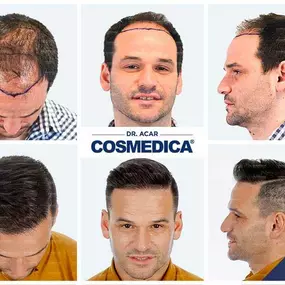 Bild von Cosmedica - Clinique de greffe de cheveux France