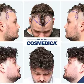 Bild von Cosmedica - Clinique de greffe de cheveux France