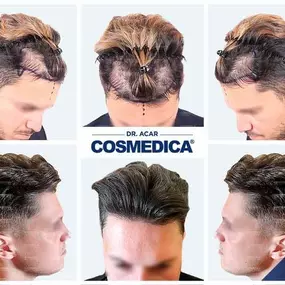 Bild von Cosmedica - Clinique de greffe de cheveux France