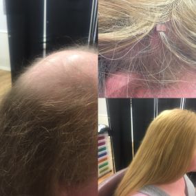 Bild von Adele Hair Loss Technician /Hairdresser