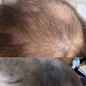 Bild von Adele Hair Loss Technician /Hairdresser