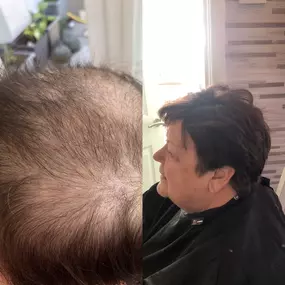 Bild von Adele Hair Loss Technician /Hairdresser