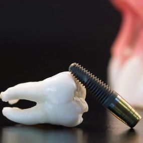 Bild von Almeida & Bell Dental Denver - General, Cosmetic, and Implant Dentistry