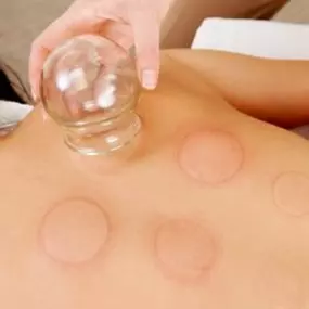 Bild von Heilpraktiker-Team Michel | TCM, Akupunktur & Dry Needling München