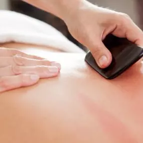 Bild von Heilpraktiker-Team Michel | TCM, Akupunktur & Dry Needling München