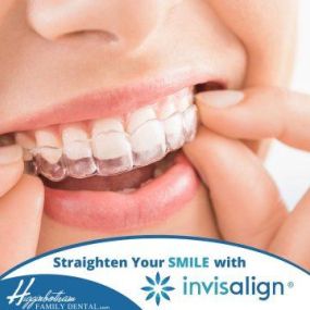 Invisalign