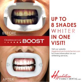 Opalescence BOOST teeth whitening