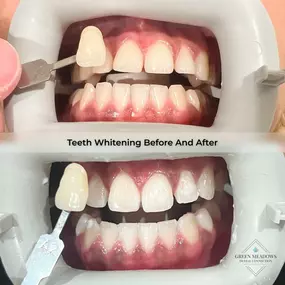 Bild von Green Meadows Dental Connection