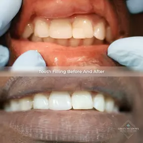 Bild von Green Meadows Dental Connection