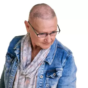 Alopecia Totalis