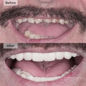 Bild von Michigan Dental Implant Studio