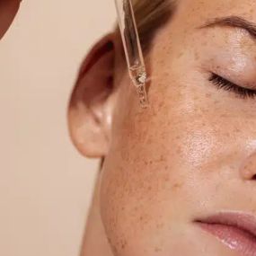 Woman applying an acne treatment solution to her face