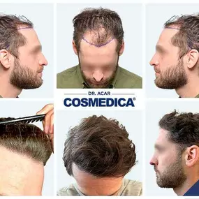 Bild von Cosmedica - Hair Transplant Turkey