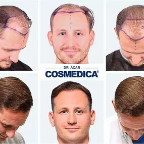 Bild von Cosmedica - Hair Transplant Turkey