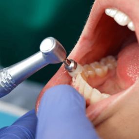 Bild von Advanced Dental Care of Fortville