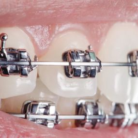 Bild von Quest Orthodontics: Dr. Arjun Patel
