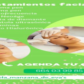 tratamientos-faciales-en-nerja.jpeg