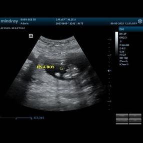 Bild von (Arlington) Baby Bee 3D Ultrasound + Studio