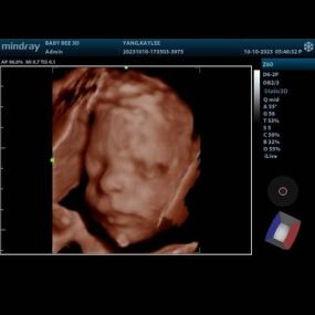 Bild von (Arlington) Baby Bee 3D Ultrasound + Studio