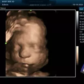 Bild von Baby Bee 3D Ultrasound + Photography Studio (Arlington)