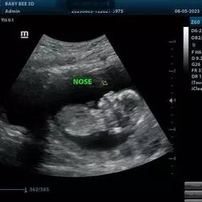 Bild von Baby Bee 3D Ultrasound + Photography Studio (Arlington)