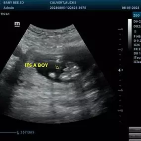 Bild von Baby Bee 3D Ultrasound + Photography Studio (Arlington)