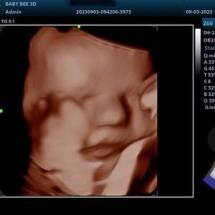 Logo from (Arlington) Baby Bee 3D Ultrasound + Studio