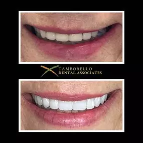 Bild von Tamborello Dental Associates