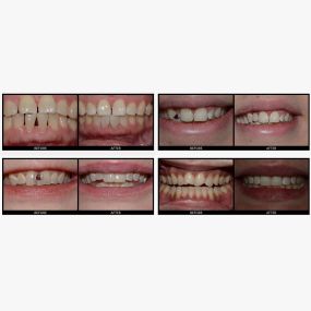 Bild von Crown Dental