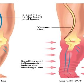 Bild von PHOENIX ULTRASOUND