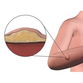 Bild von PHOENIX ULTRASOUND