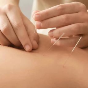 Bild von Gate of Balance Acupuncture