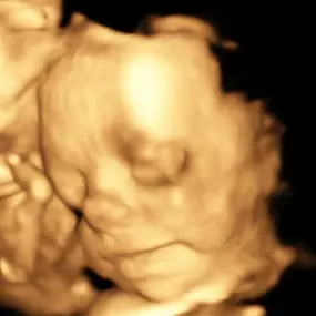 Bild von Butterfly Kisses Ultrasound Imaging Center