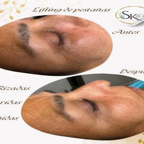 Estetica-Skinlaser01.jpeg