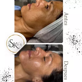 Estetica-Skinlaser00.jpeg