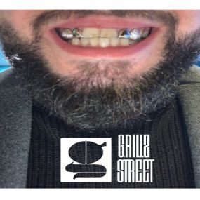 Bild von GRILLZSTREET - Grillz sur mesure