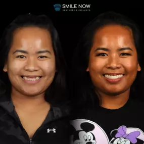 Bild von Smile Now Eugene Dentures and Implants