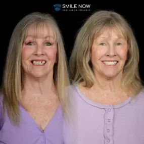 Bild von Smile Now Eugene Dentures and Implants