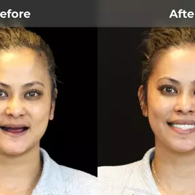 Bild von Smile Now Eugene Dentures and Implants